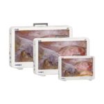 Caméra endoscopique portable CF916 15,6 pouces – Image 4