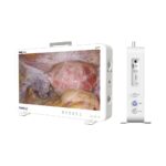 Caméra endoscopique portable tout-en-un Camjoy CK927 27 pouces 4K UHD