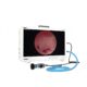 full HD endoscope camera