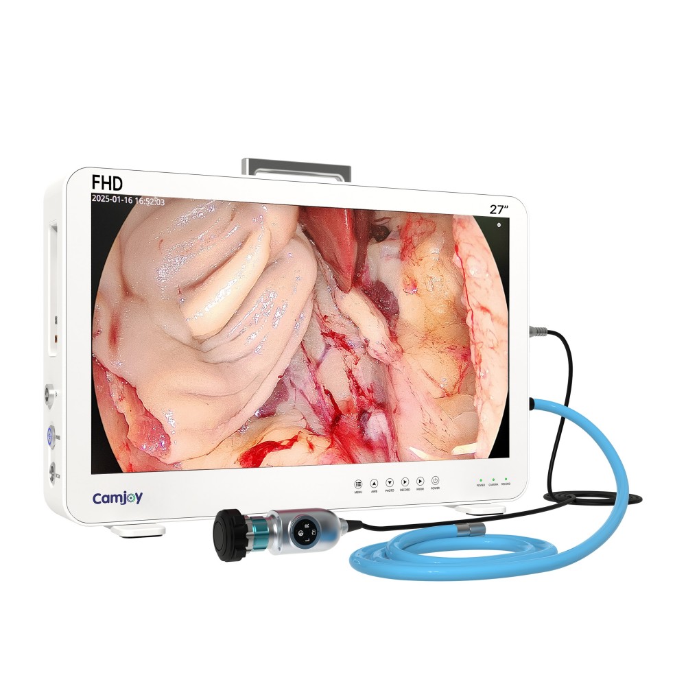 Camjoy CF927 27 Large Screen FHD Endoscope Camera System Surgical Visualization FHD 01 Camjoy CF927 27 Large Screen FHD Endoscope Camera System Surgical Visualization FHD 01
