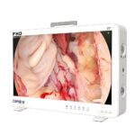 Camjoy CF927 27 Gros écran FHD Endoscope Système de caméra Visualisation chirurgicale FHD 02