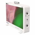 Camjoy CG932 32 pouces 4K-ICG FPGA Endoscope Système 02