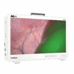 Camjoy CG932 32 pouces 4K-ICG FPGA Endoscope Système 03