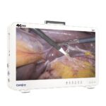 Camjoy CK932 32 Système d’endoscopie 4K grand format Premium Équipement OR 4K 02