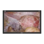 Camjoy CF1 32-inch black FHD surgical monitor front view